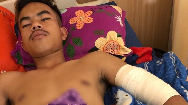 កូន​ប្រុស​សកម្ម​ជន​បក្ស​ភ្លើង​ទៀន​ខេត្ត​ត្បូង​ឃ្មុំ​ត្រូវជន​មិន​ស្គាល់​មុខ​យក​កាំបិត​គប់​បណ្ដាល​ឱ្យ​រង​របួស​